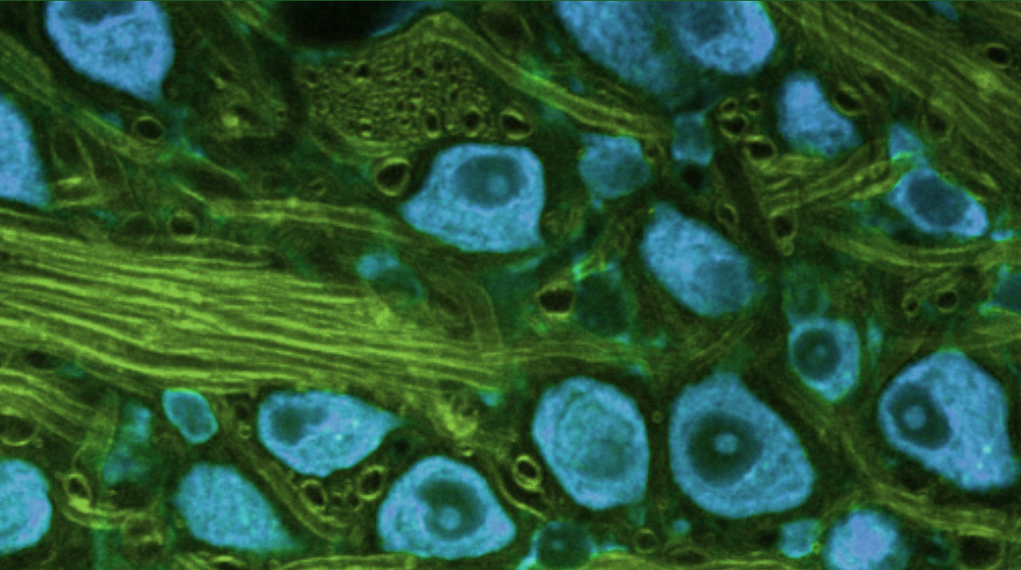 Reversing aging at the molecular level